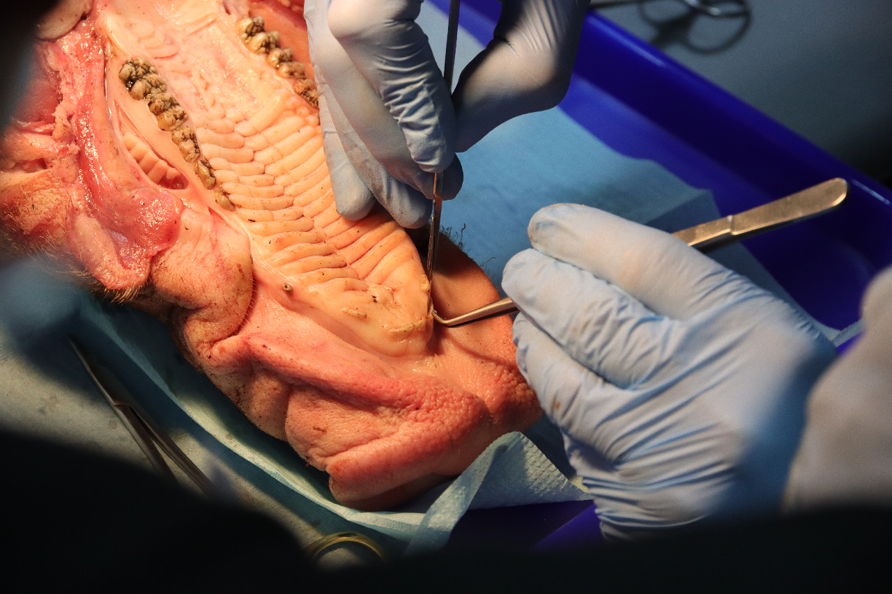 Пластика мягких тканей вокруг имплантатов. Морфологический подход