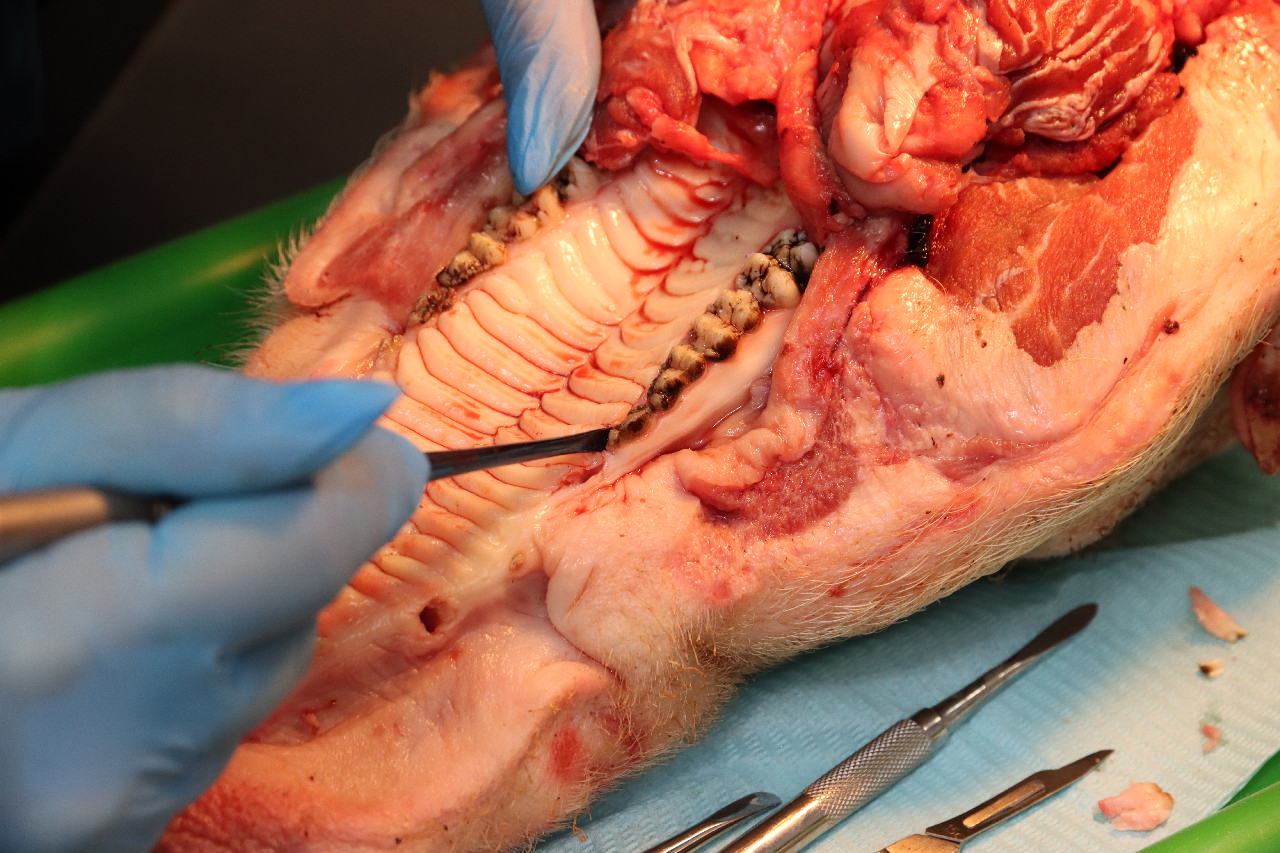 Атравматичное удаление зубов и методики наложения швов