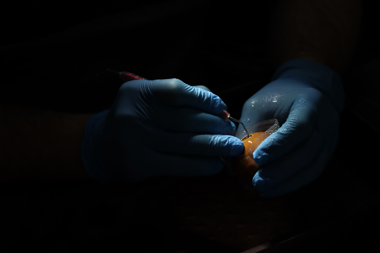 Продвинутый курс по имплантации: костная пластика и синус-лифтинг