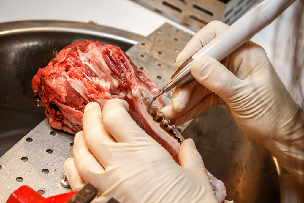 Атравматичное удаление зубов и методики наложения швов