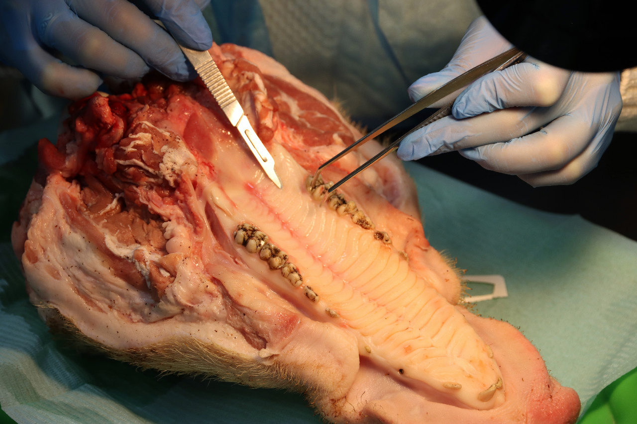 Пластика мягких тканей вокруг имплантатов. Морфологический подход