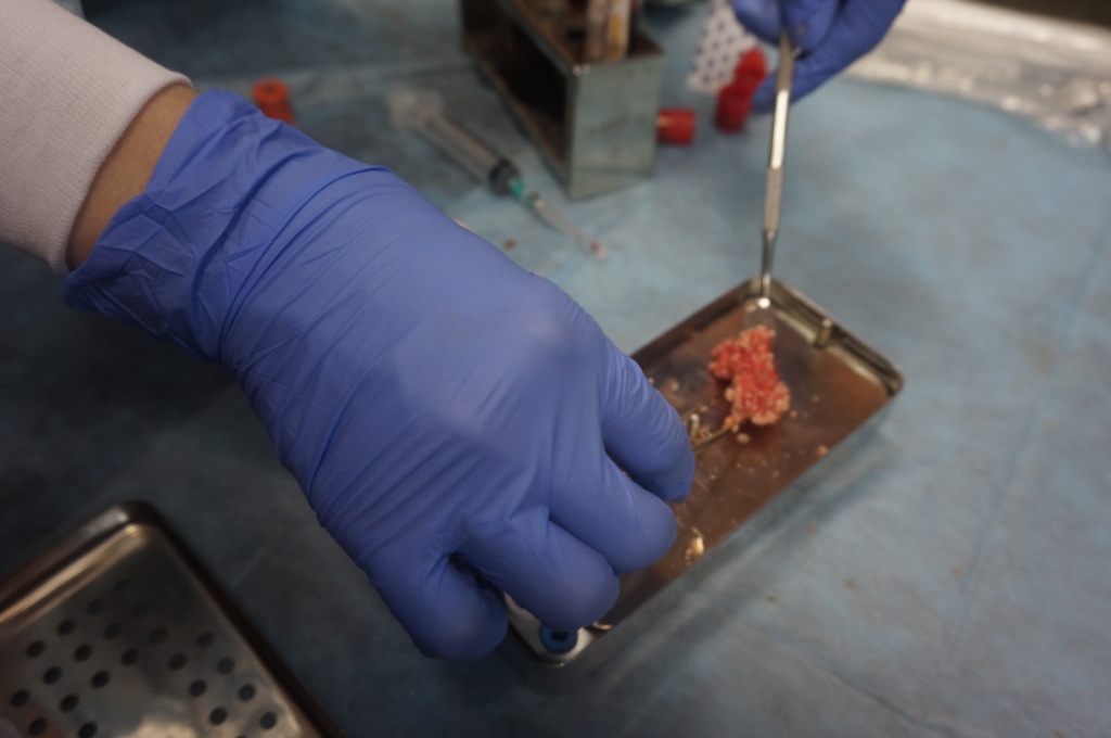 Лекция по аутоплазмотерапии: применение факторов роста А-PRF и I-PRF в стоматологии. Контурная пластика жидким PRF нижней трети части лица