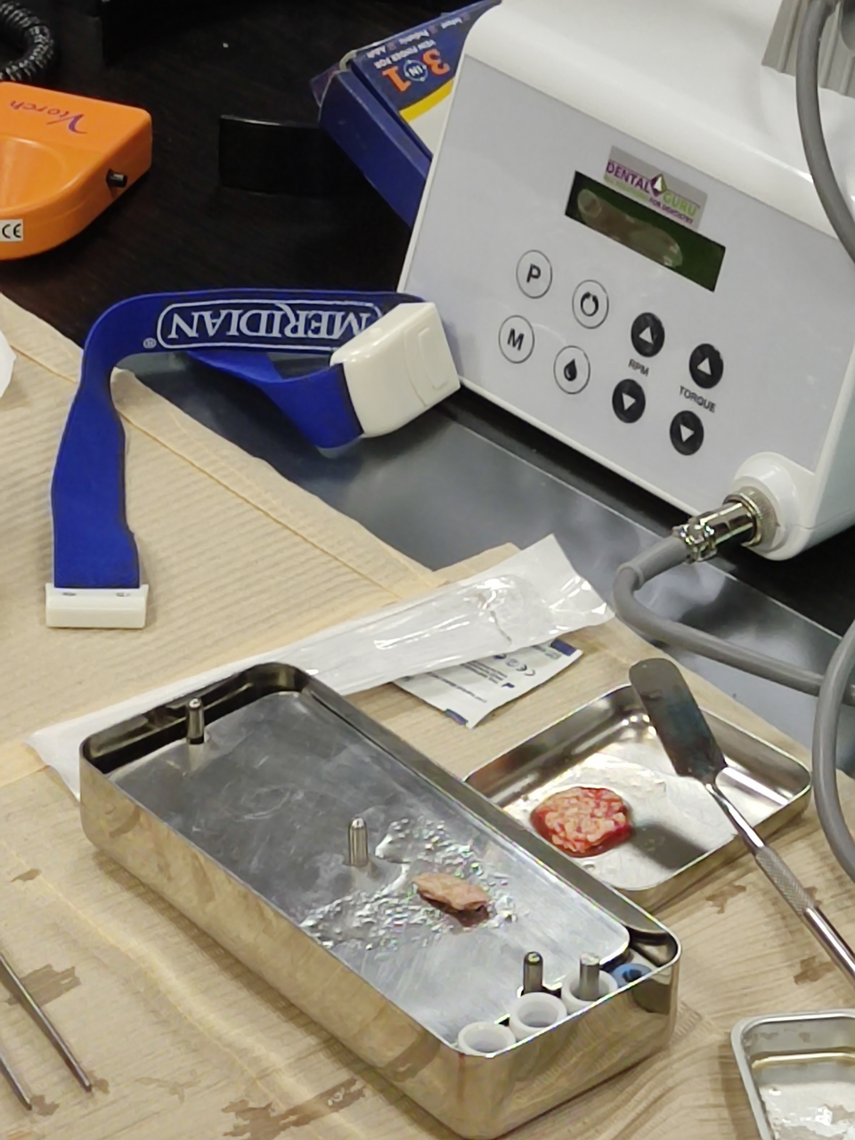 Плазмотерапия PRF в стоматологии