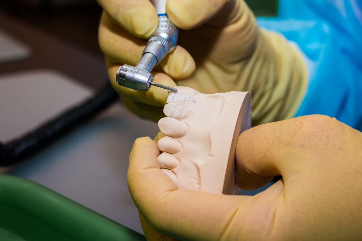 Препарирование зубов под цельнокерамические реставрации во фронтальном отделе, 26 февраля 2020г.