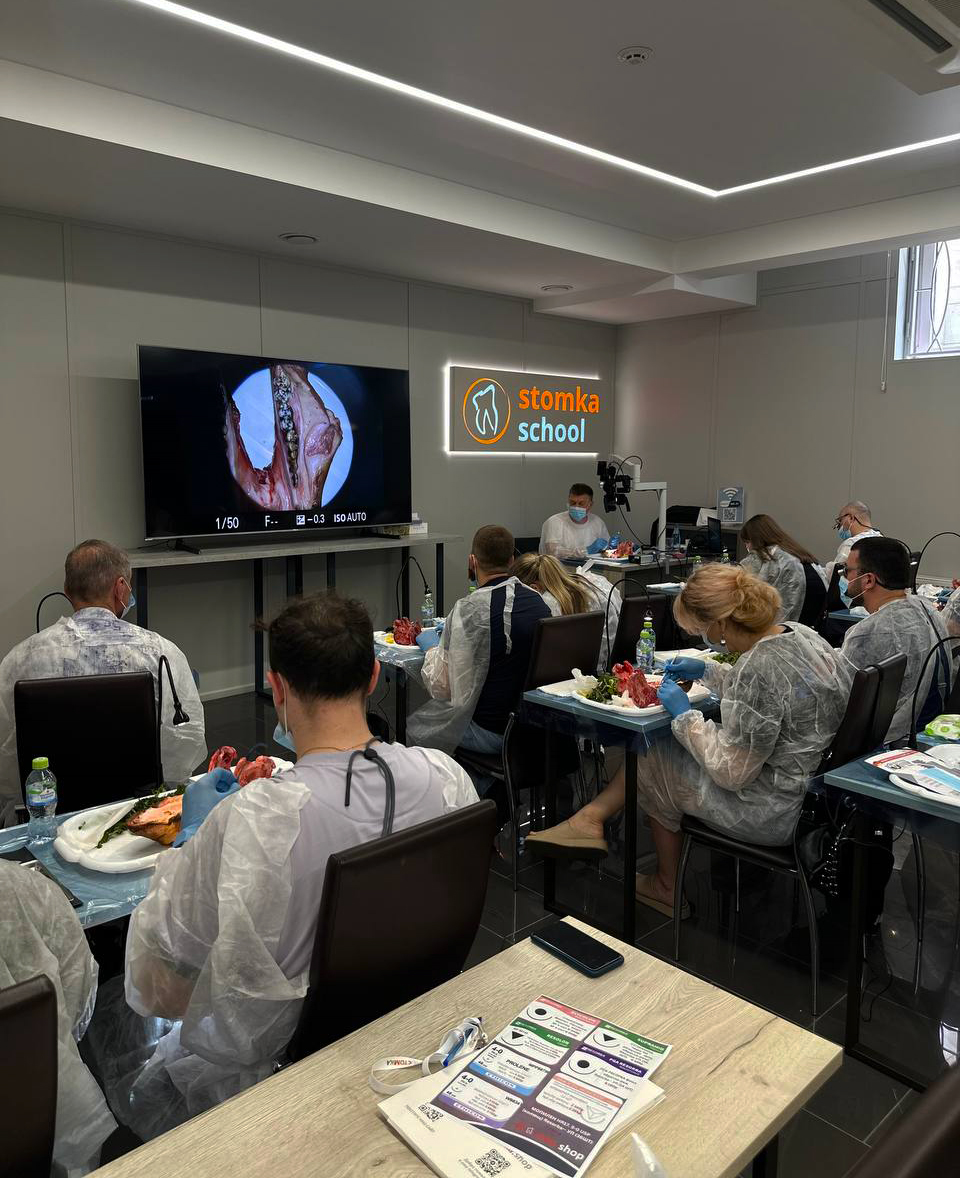 Пластика мягких тканей в периимплантатной области