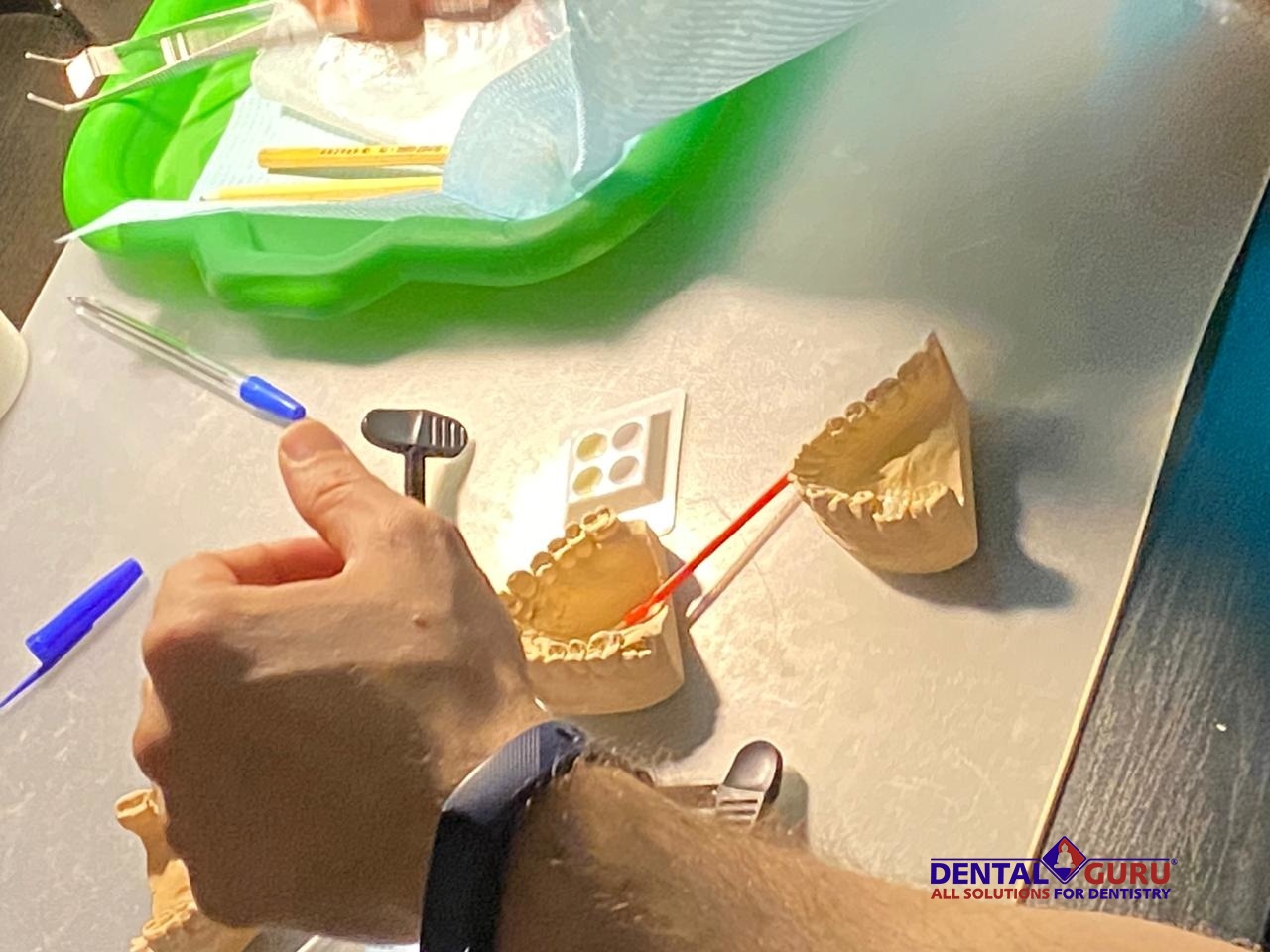 Прямые реставрации повышенной прочности. Пост-релиз 17.12.20