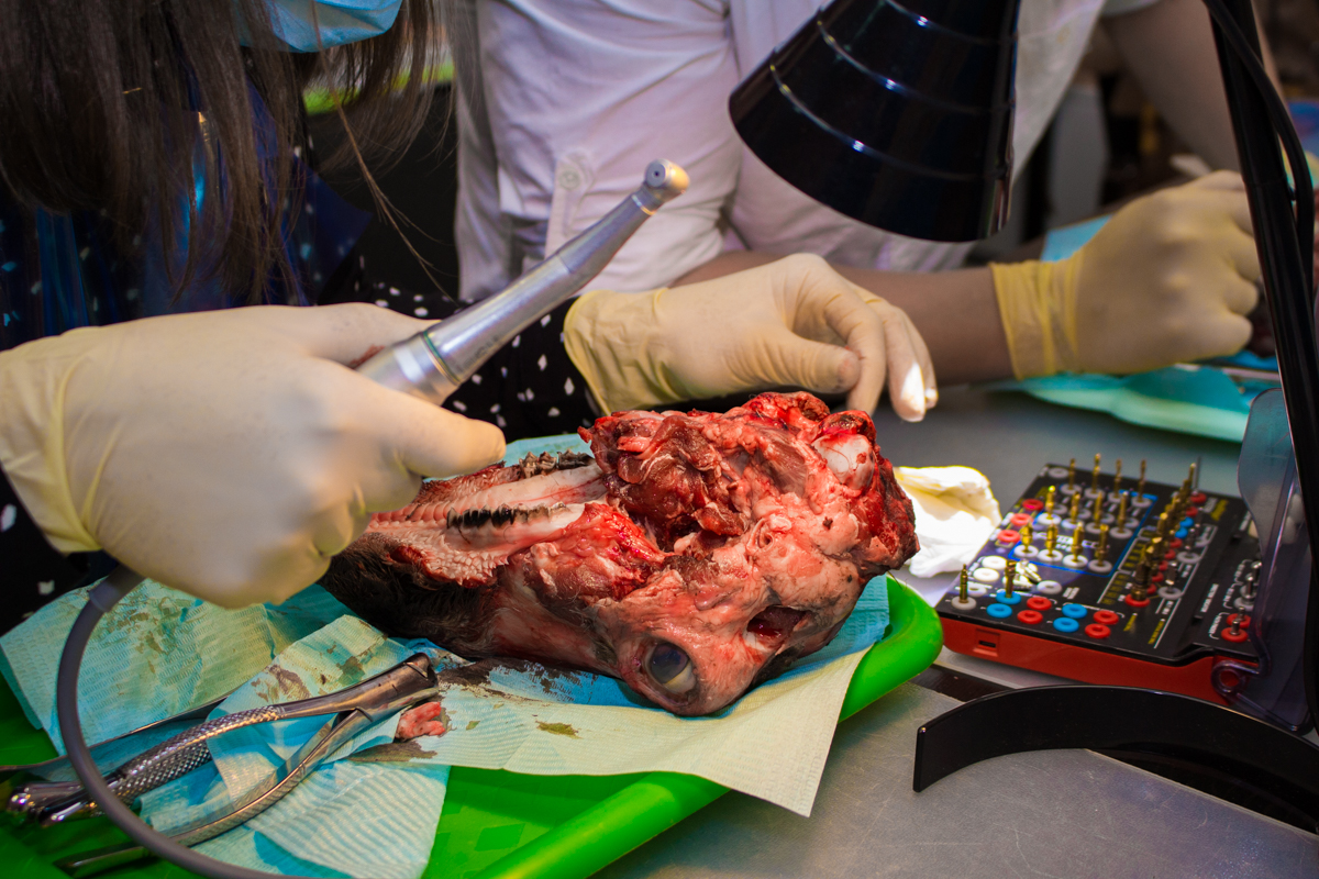 Одномоментная имплантация и немедленная нагрузка. 3 февраля 2020