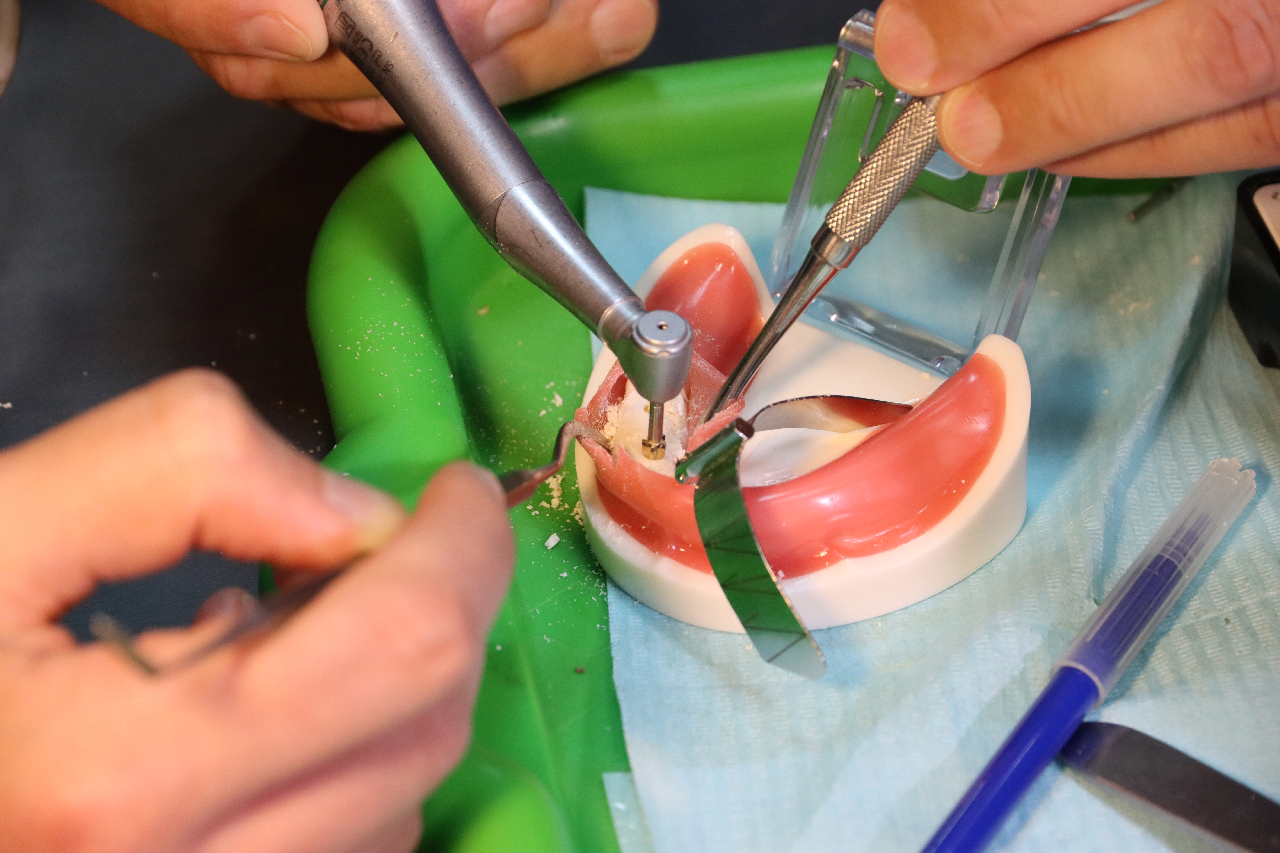 Экспертный курс по тотальной имплантации и протезированию при полном отсутствии зубов