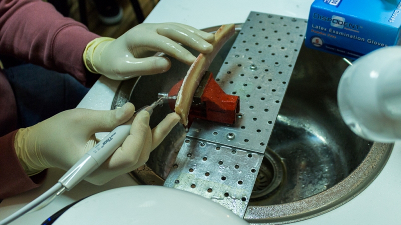 Продвинутый курс по имплантации. Костная пластика