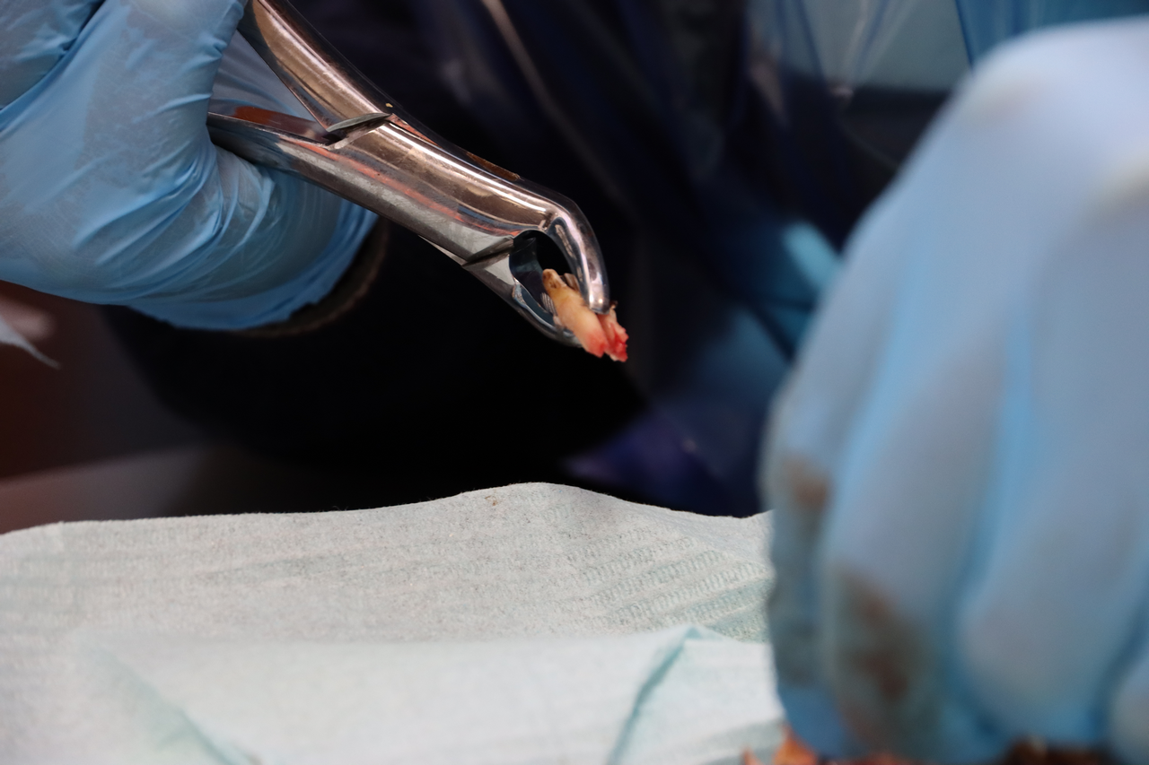 Атравматичное удаление зубов и методики наложения швов 26.01.22