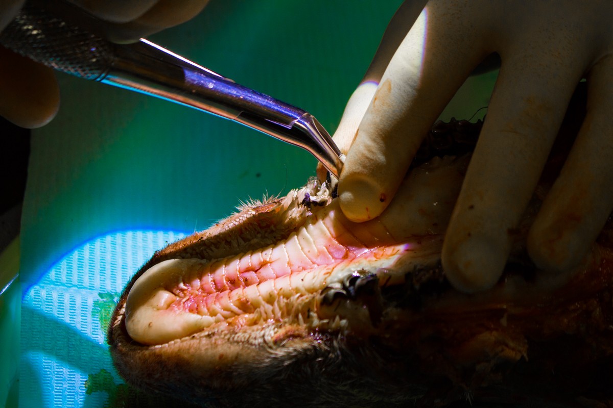 Одномоментная имплантация и немедленная нагрузка. 3 февраля 2020