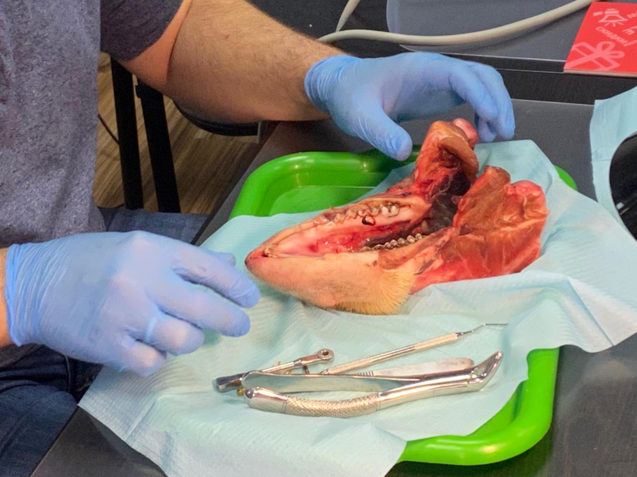 Дентальная имплантация с одновременной пластикой мягких тканей в сложных клинических случаях. 3 апреля 2021