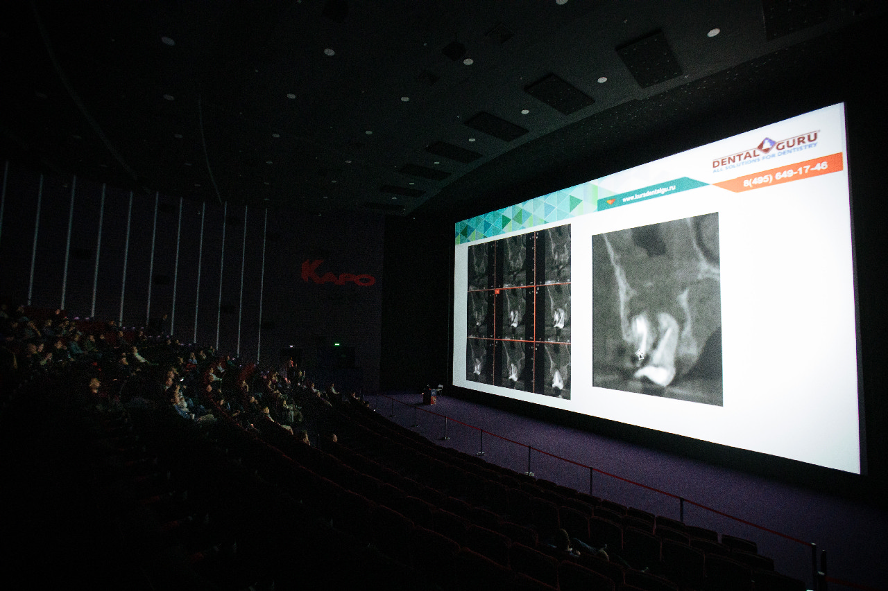 Киноконгресс Осложнения в имплантации