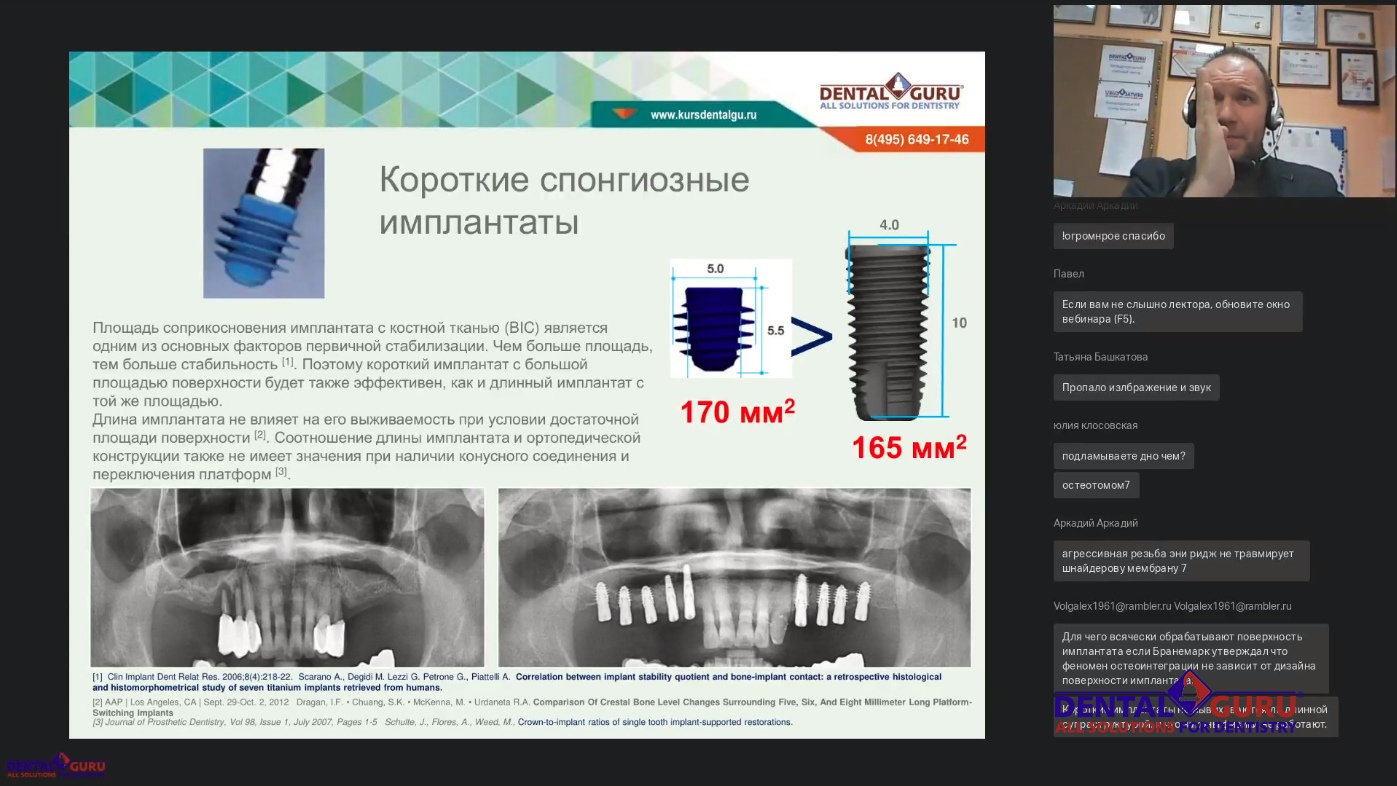 Пост-релиз: Взаимодействие имплантолога и лор-врача при проведении имплантации и костной пластики в компрометированной пазухе