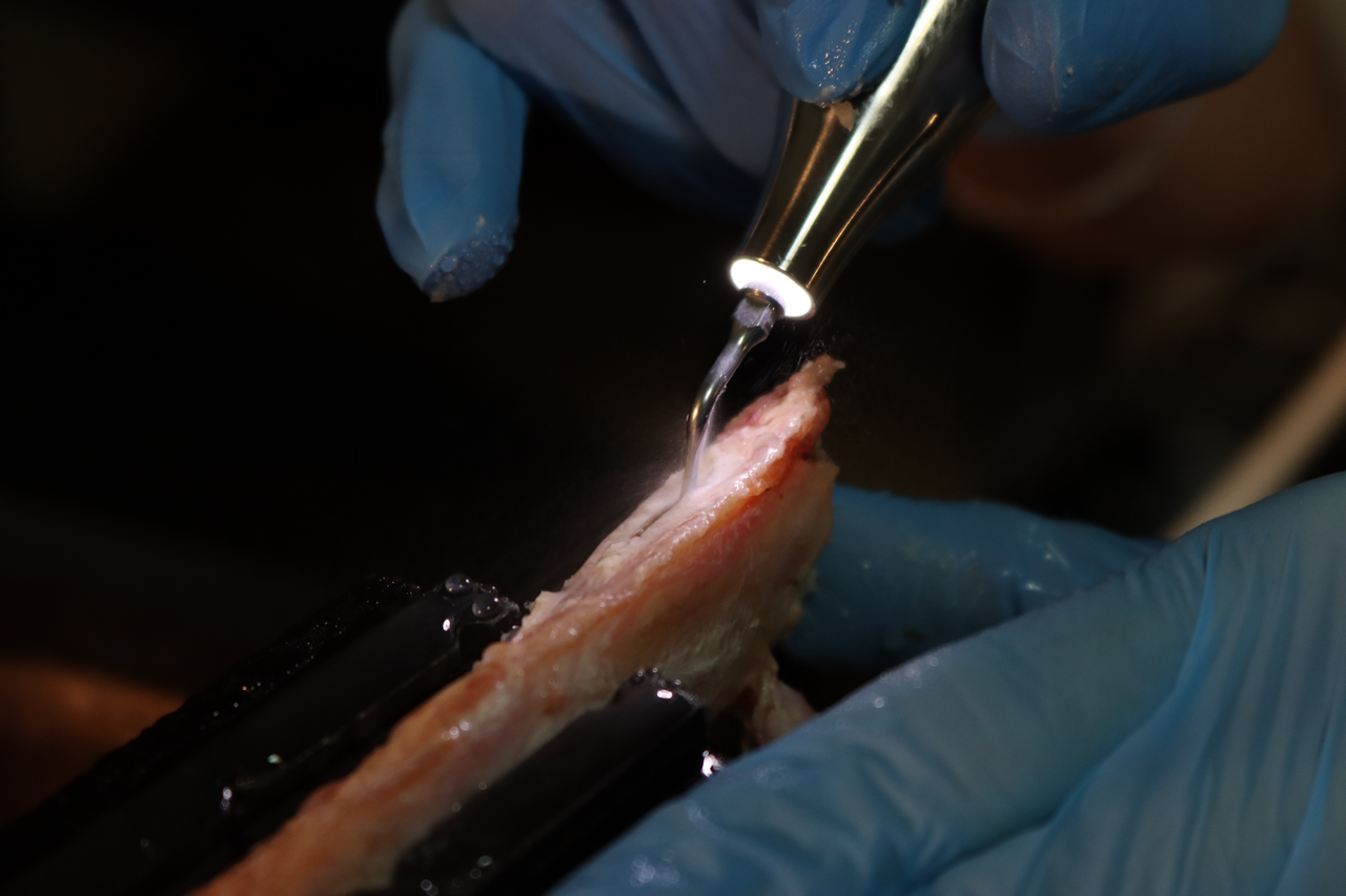 Продвинутый курс по имплантации. Костная пластика