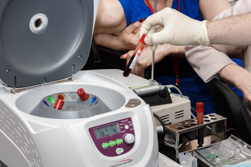 Применение факторов роста (IPRF, APRF) в стоматологии