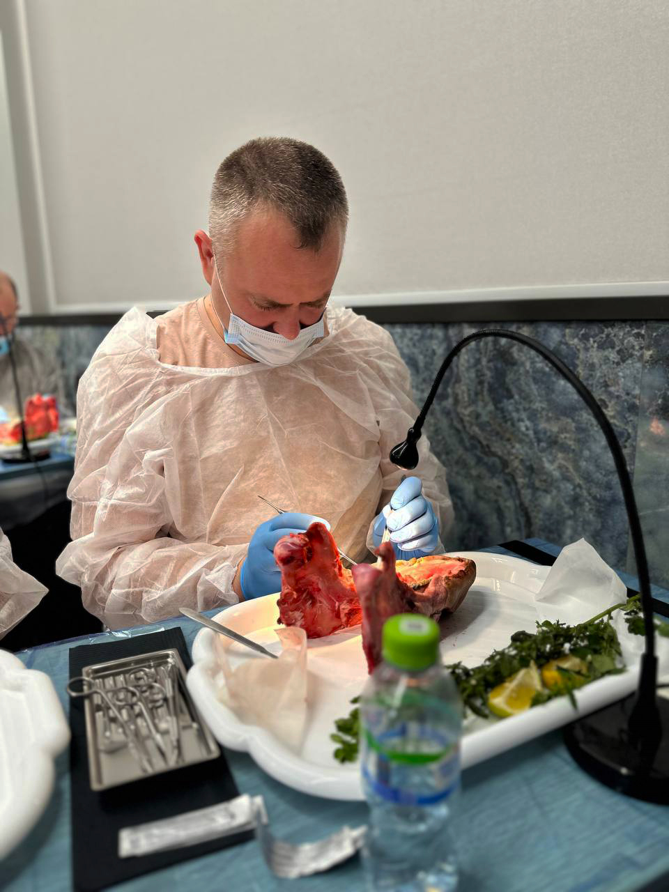 Пластика мягких тканей в периимплантатной области