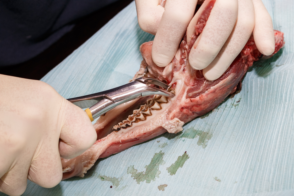 Атравматичное удаление зубов и методики наложения швов