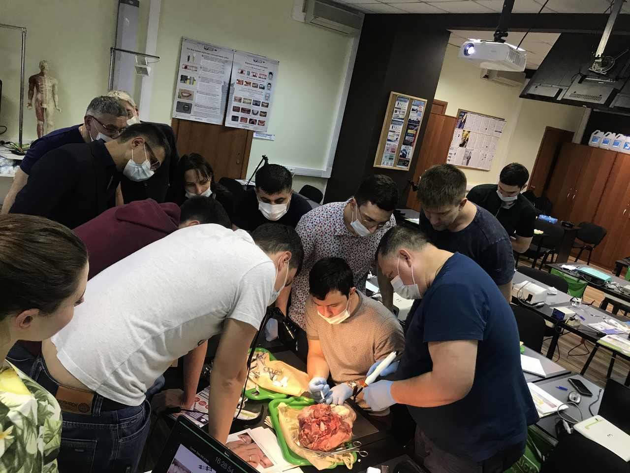 Пластика мягких тканей вокруг имплантатов. Морфологический подход. Пост-релиз 9-10 июня