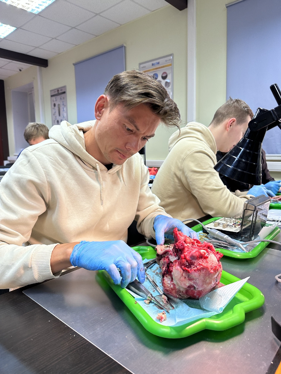 Одномоментная имплантация и немедленная нагрузка