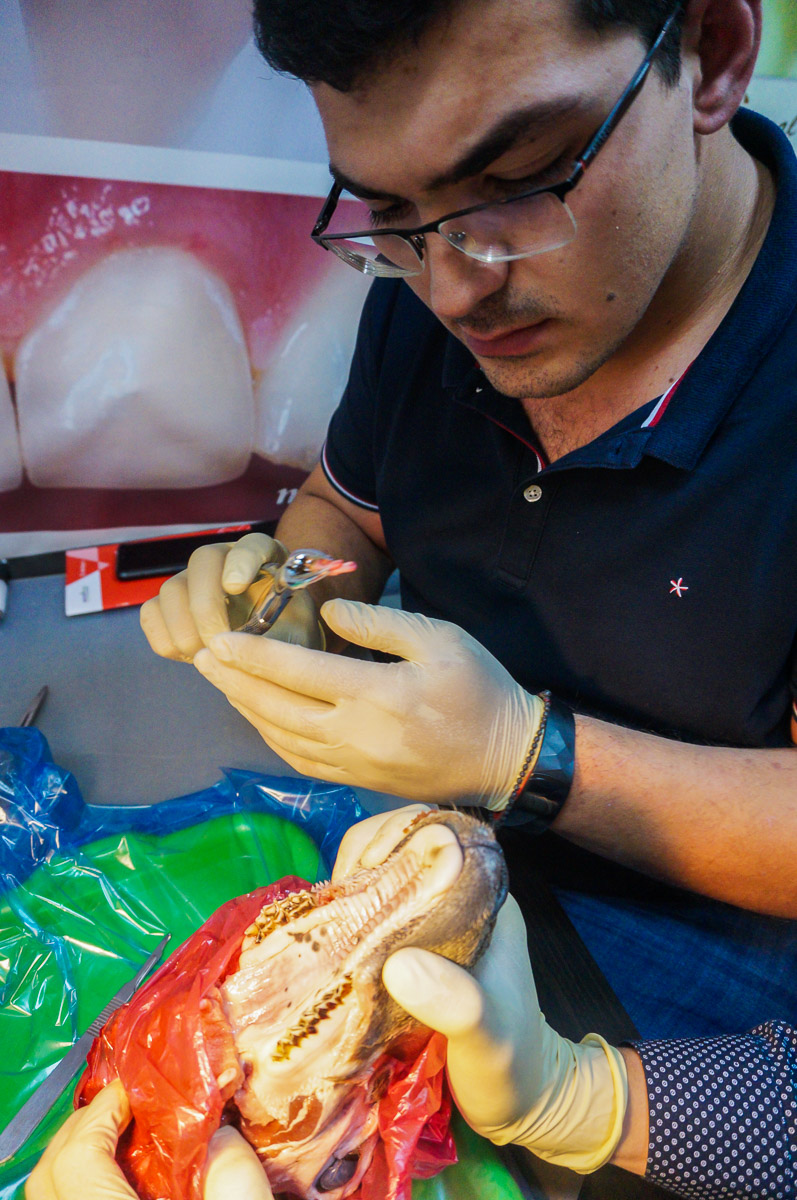 Атравматичное удаление зубов и методики наложения швов. 17 августа 2019г.