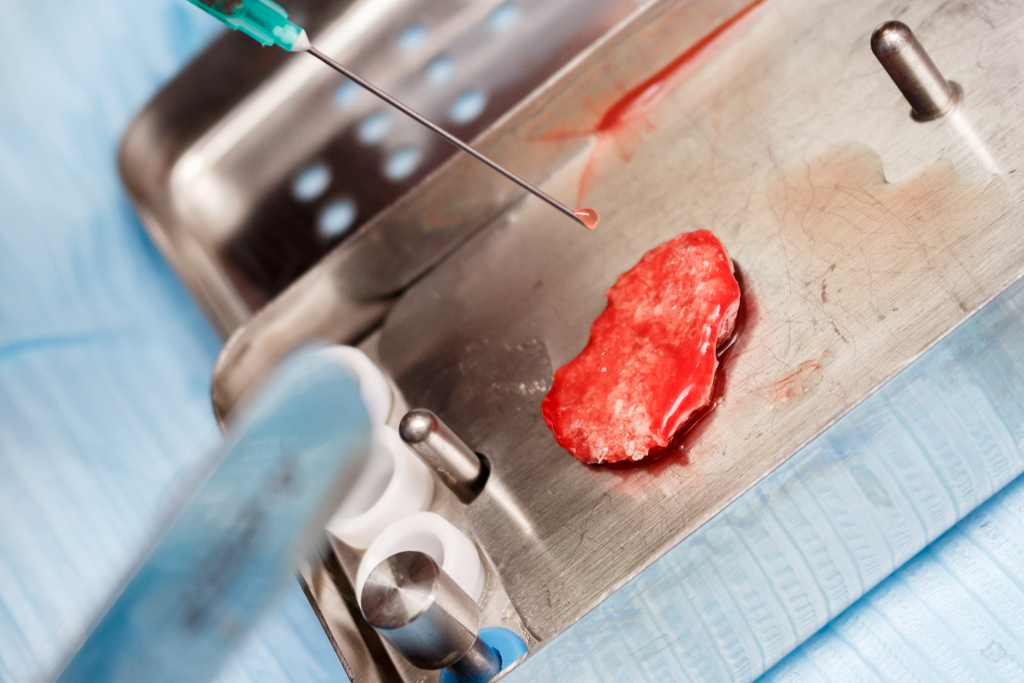 Применение факторов роста (IPRF, APRF) в стоматологии