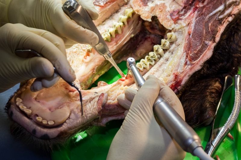 Одномоментная имплантация и немедленная нагрузка