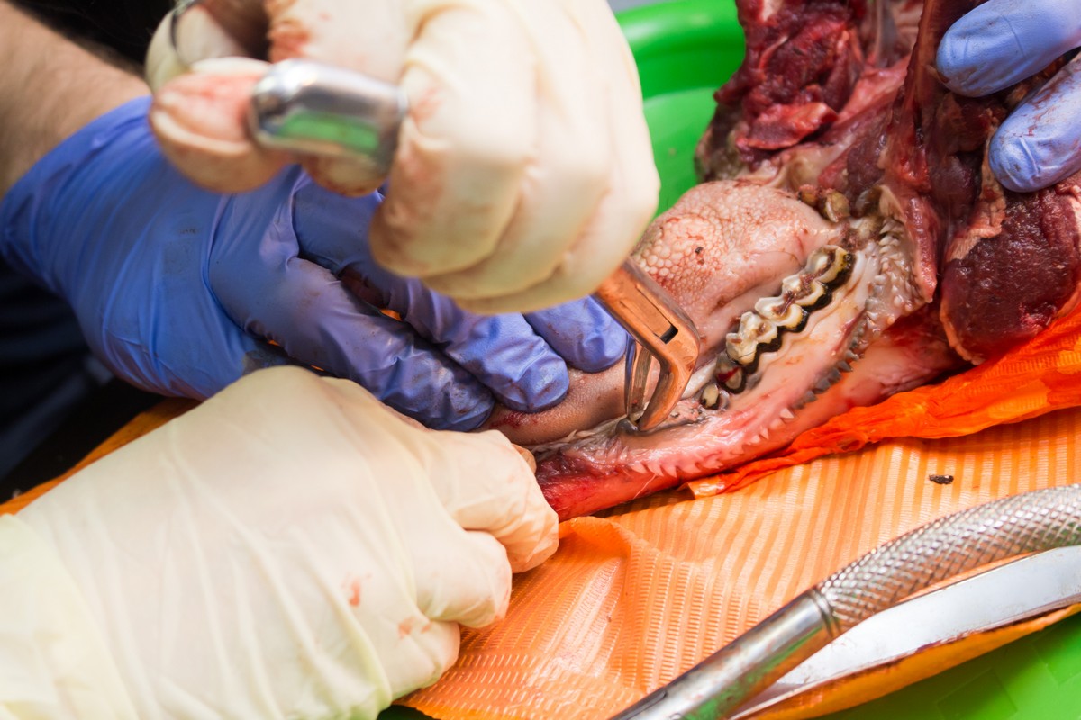 Атравматичное удаление зубов и методики наложения швов