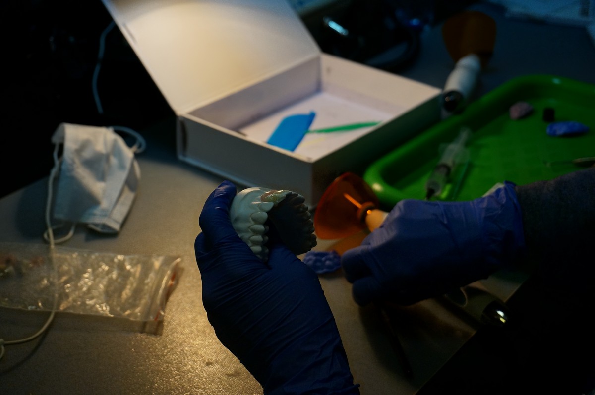 Прямая реставрация передних зубов. Эстетика, морфология, функция – ключи к успеху