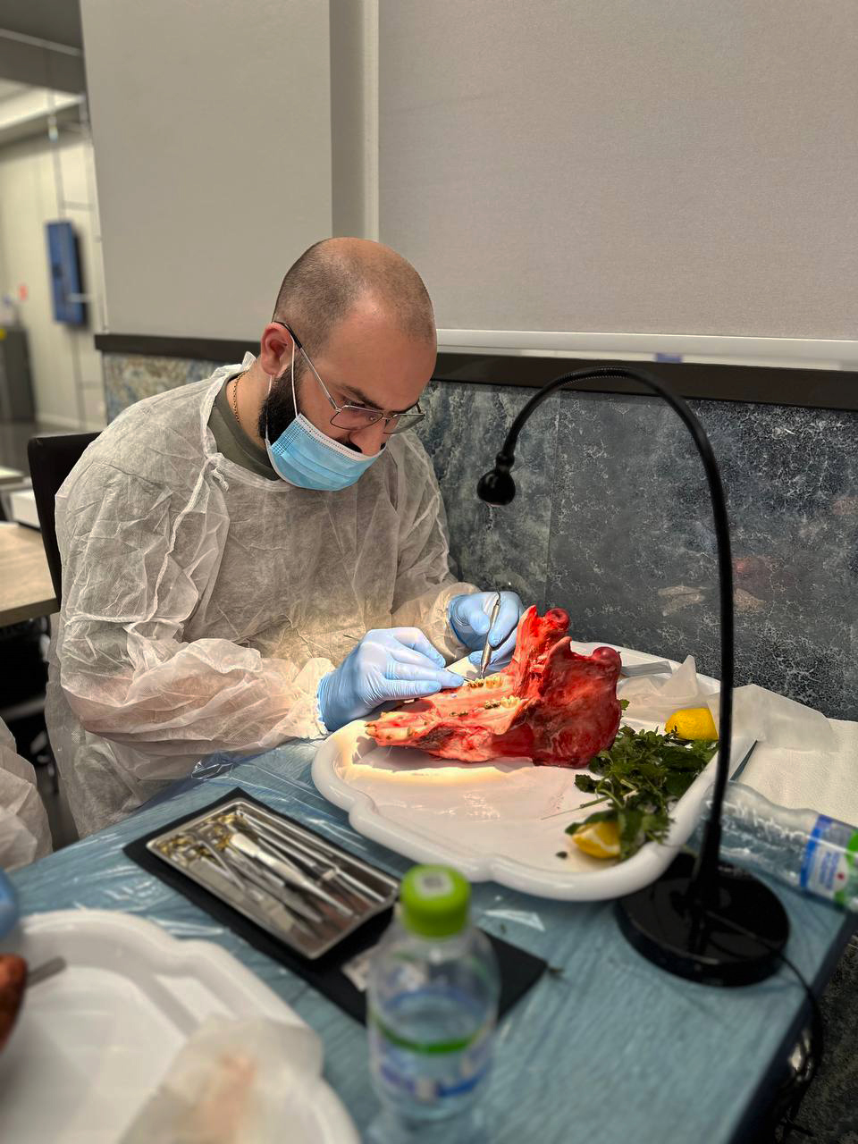 Пластика мягких тканей в периимплантатной области