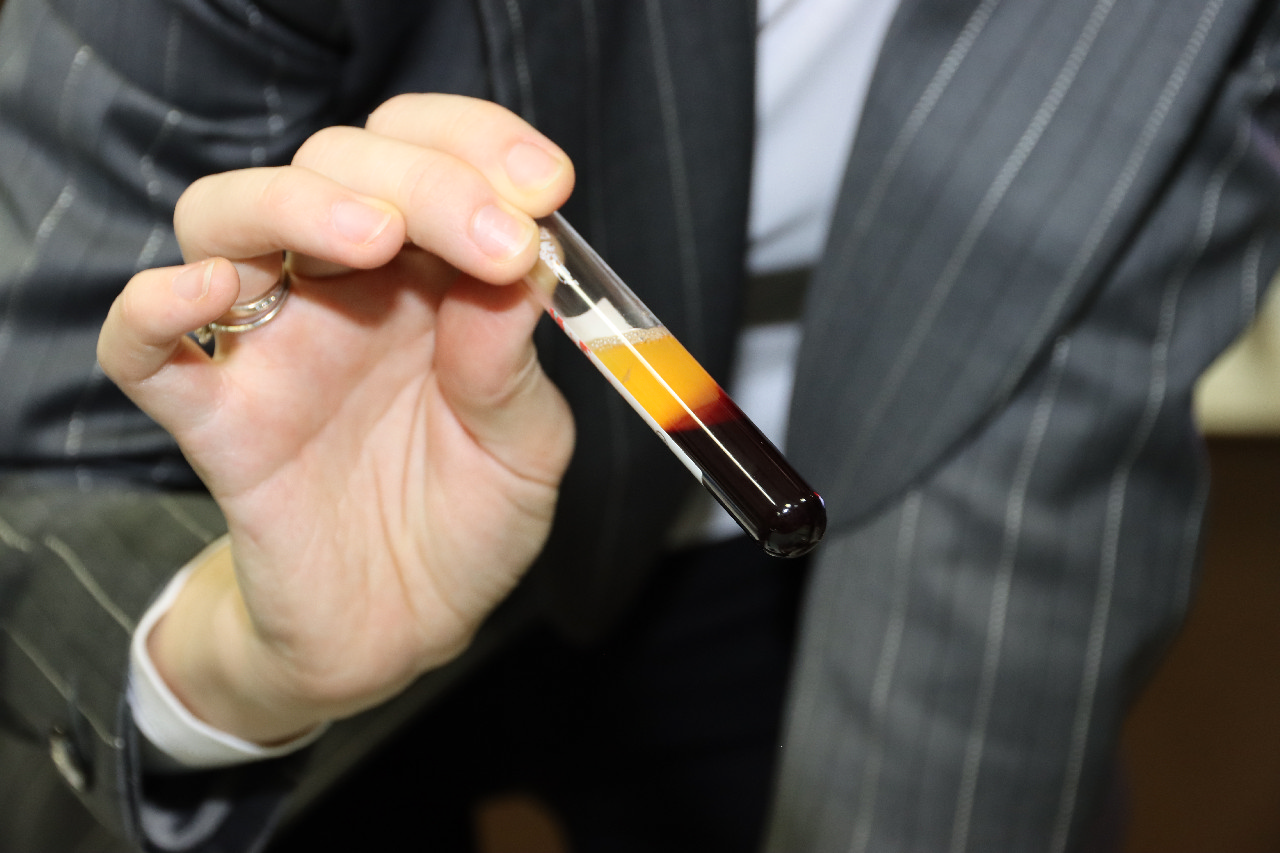 Плазмотерапия PRF в стоматологии