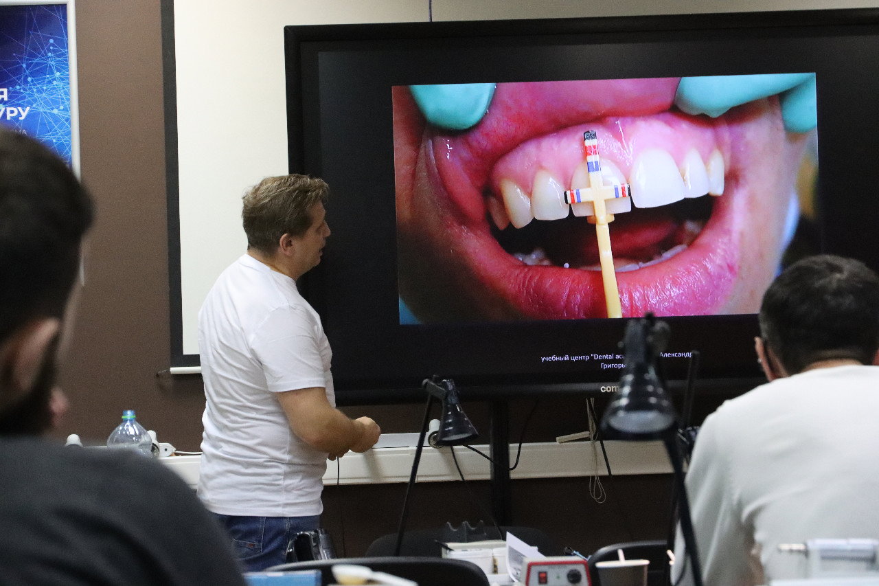 Прямые композитные виниры. Полный алгоритм и немного больше