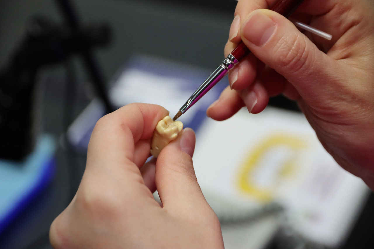 Прямые методы реставраций жевательной группы зубов