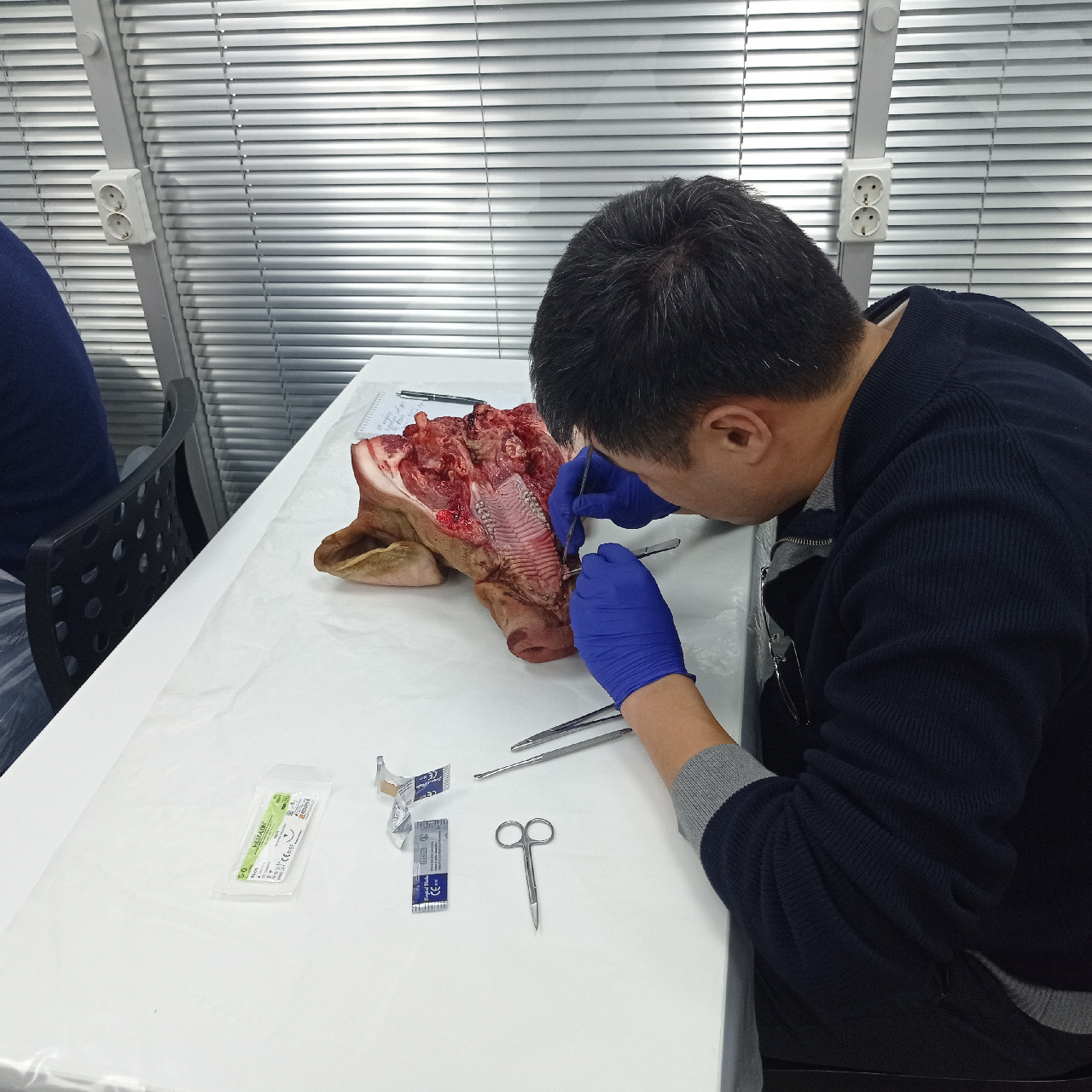 Пластика мягких тканей вокруг имплантатов. PRF в стоматологии. Курс в Казахстане