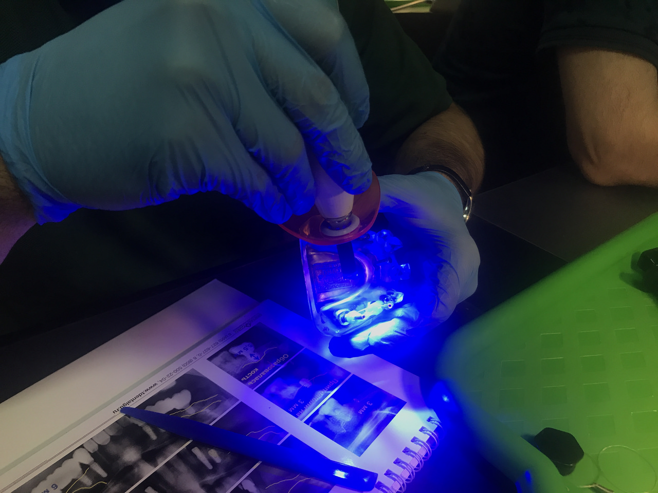 Пост-релиз: базовый курс по имплантации