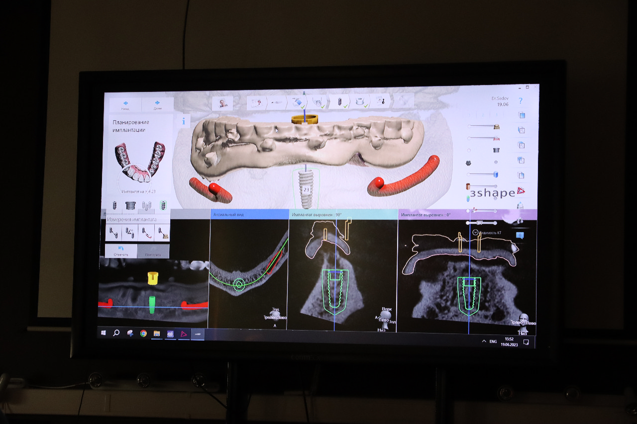 Продвинутый курс R2Gate+ExoCAD+3Shape