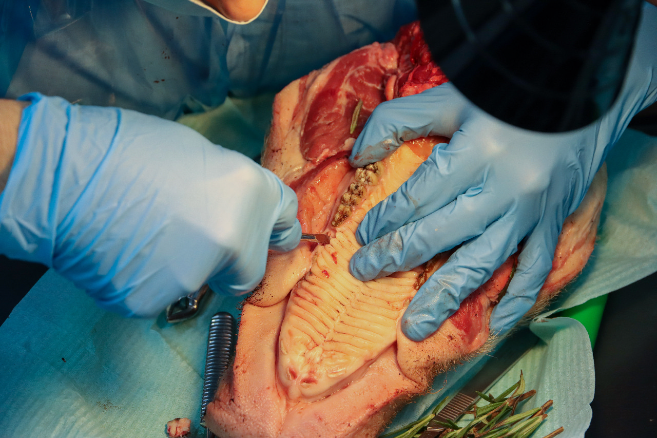 Атравматичное удаление зубов и методики наложения швов