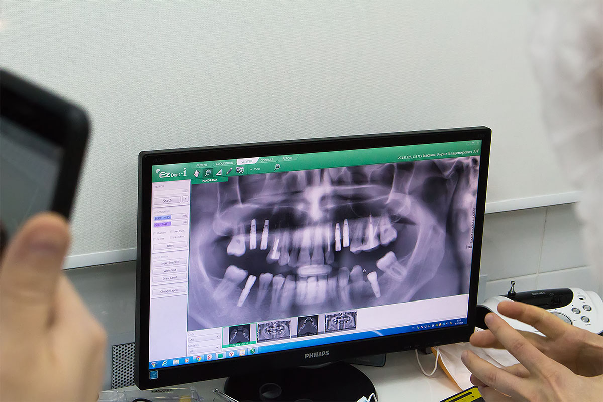 Модульный курс - Обучение секретам и нюансам имплантации на практике в условиях клиники