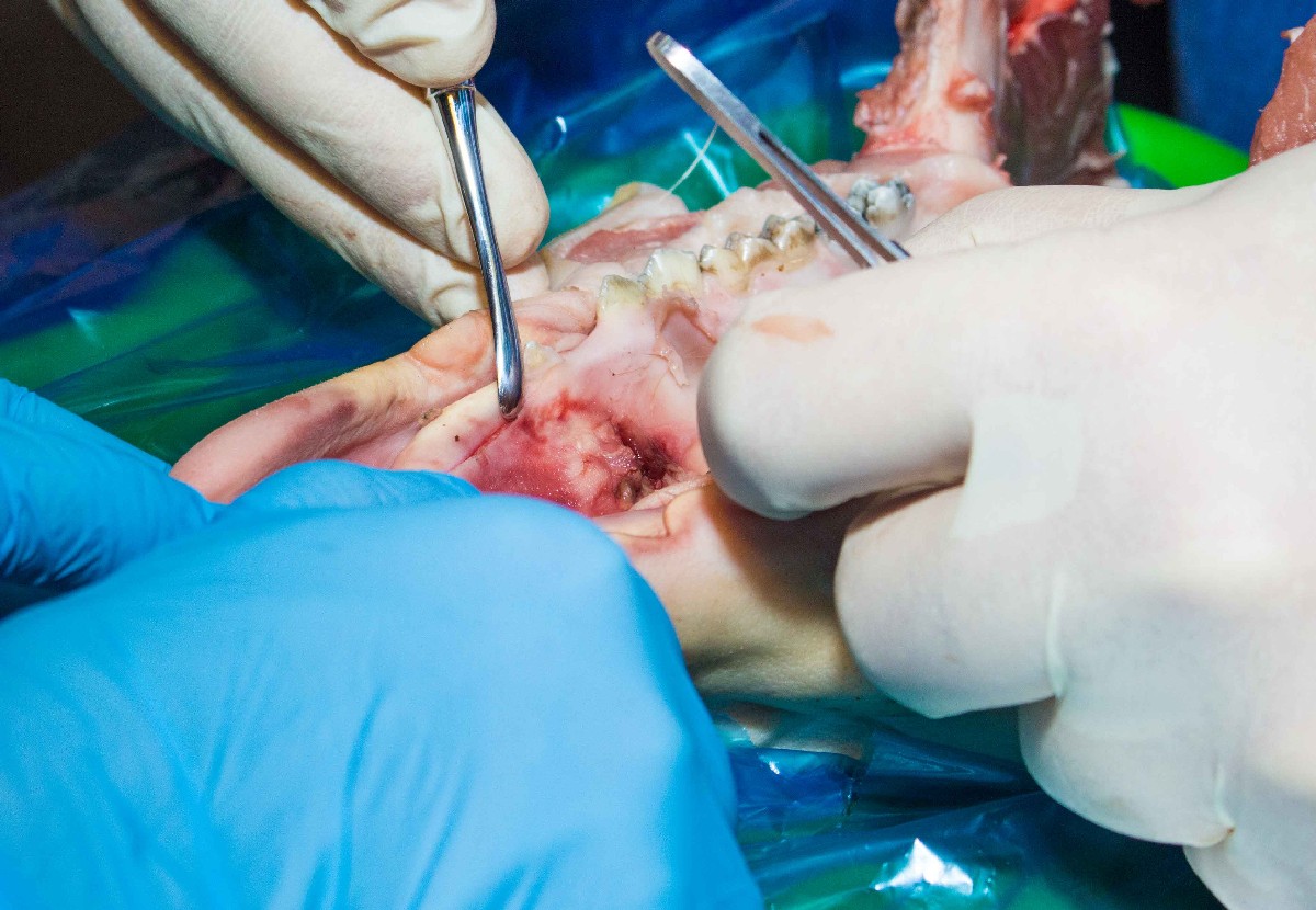 13-14 ноября. Хирургический курс по пародонтологии. Ерохин А.И.