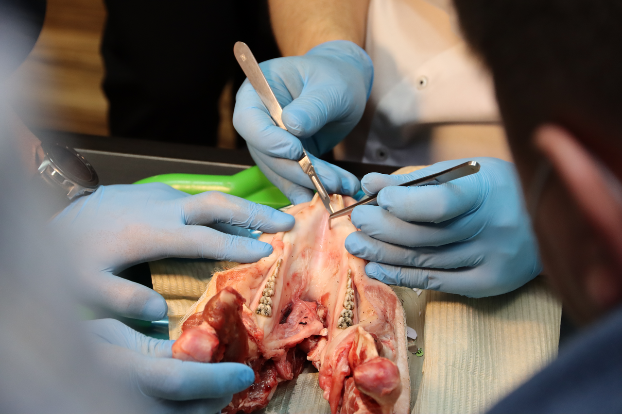 Дентальная имплантация с одновременной пластикой мягких тканей в сложных клинических случаях