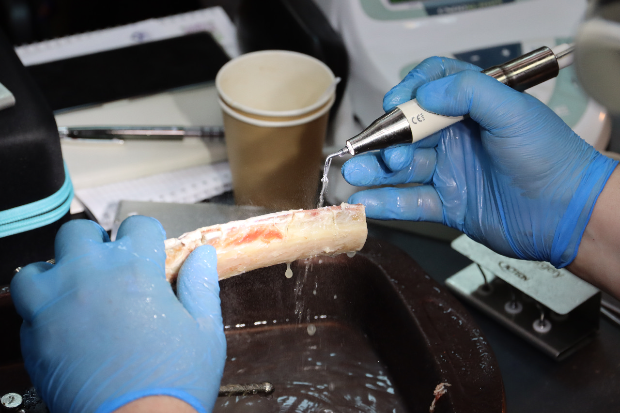 Продвинутый курс по имплантации: костная пластика и синус-лифтинг