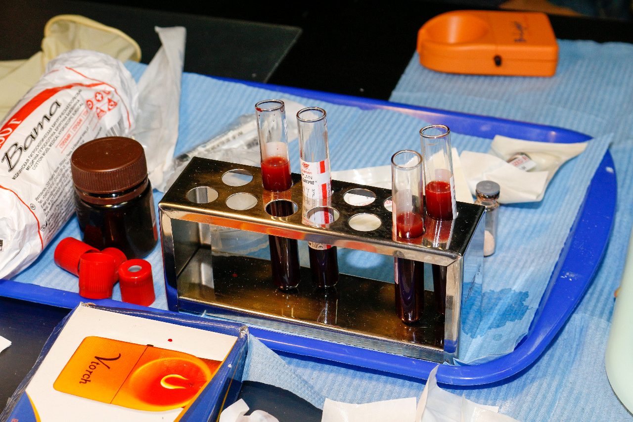 Плазмотерапия PRF в стоматологии 29.09.23