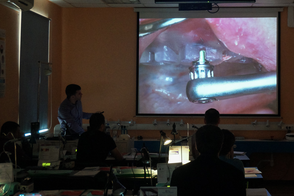 Одномоментная имплантация и немедленная нагрузка