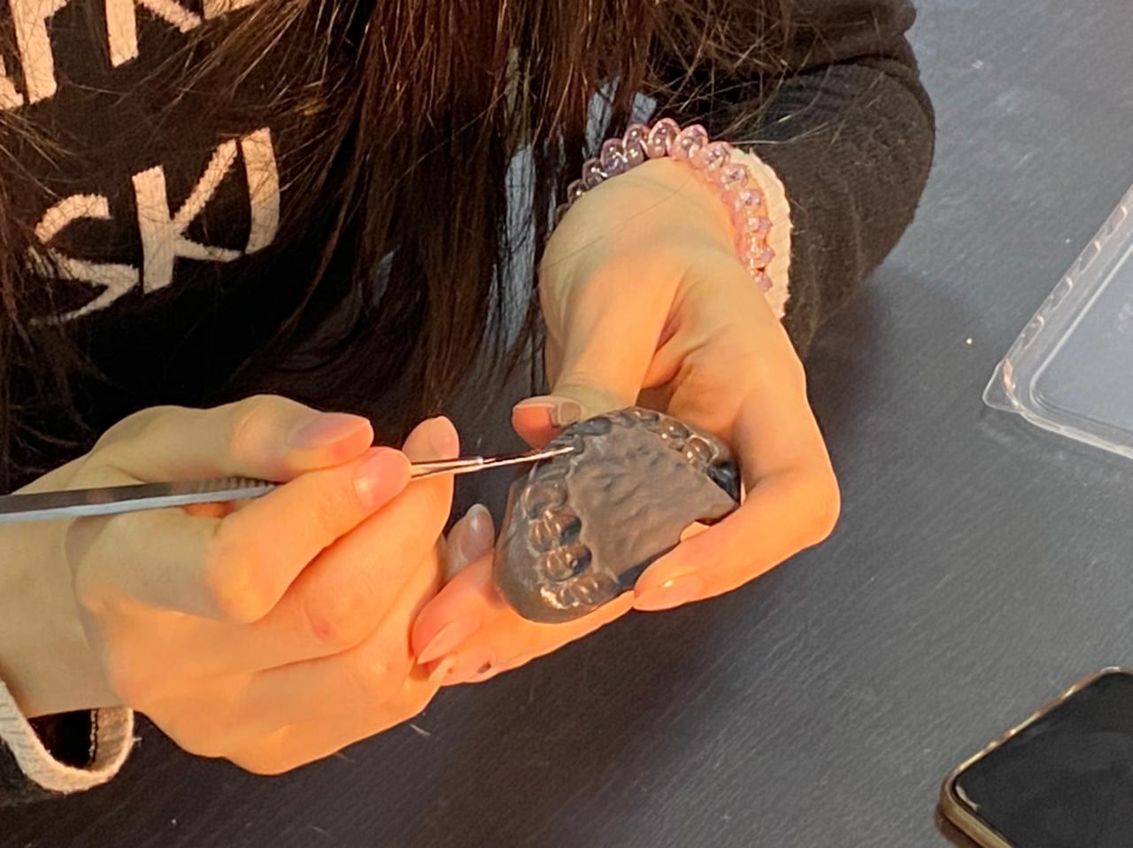 Прямые композитные виниры. Полный алгоритм и немного больше. Пост-релиз 3 марта 2021