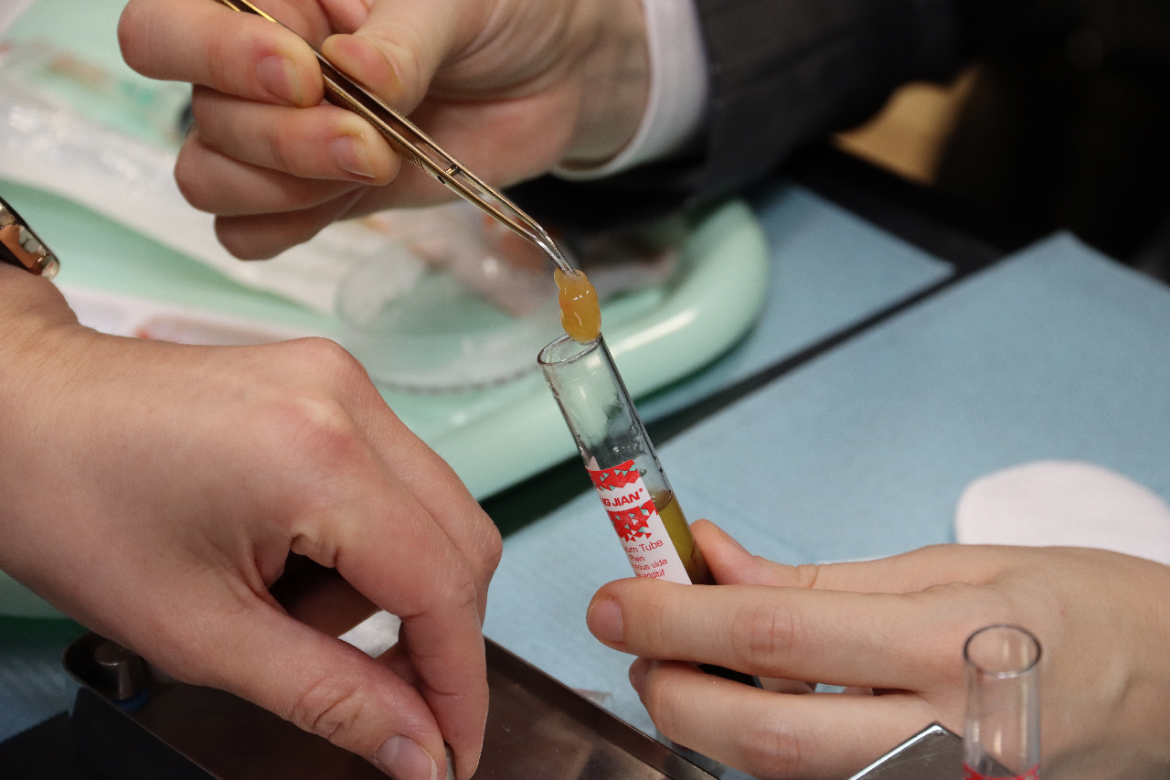 Плазмотерапия PRF в стоматологии