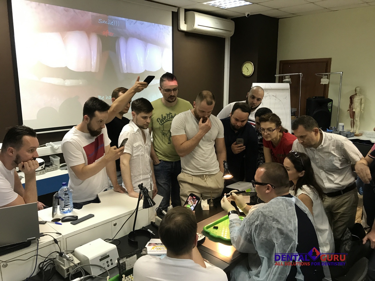 25.06.2021 Стоматологическая реабилитация с помощью ангулированных имплантатов. Имплантация на 4-х имплантатах. Физиологическое и анатомическое обоснование