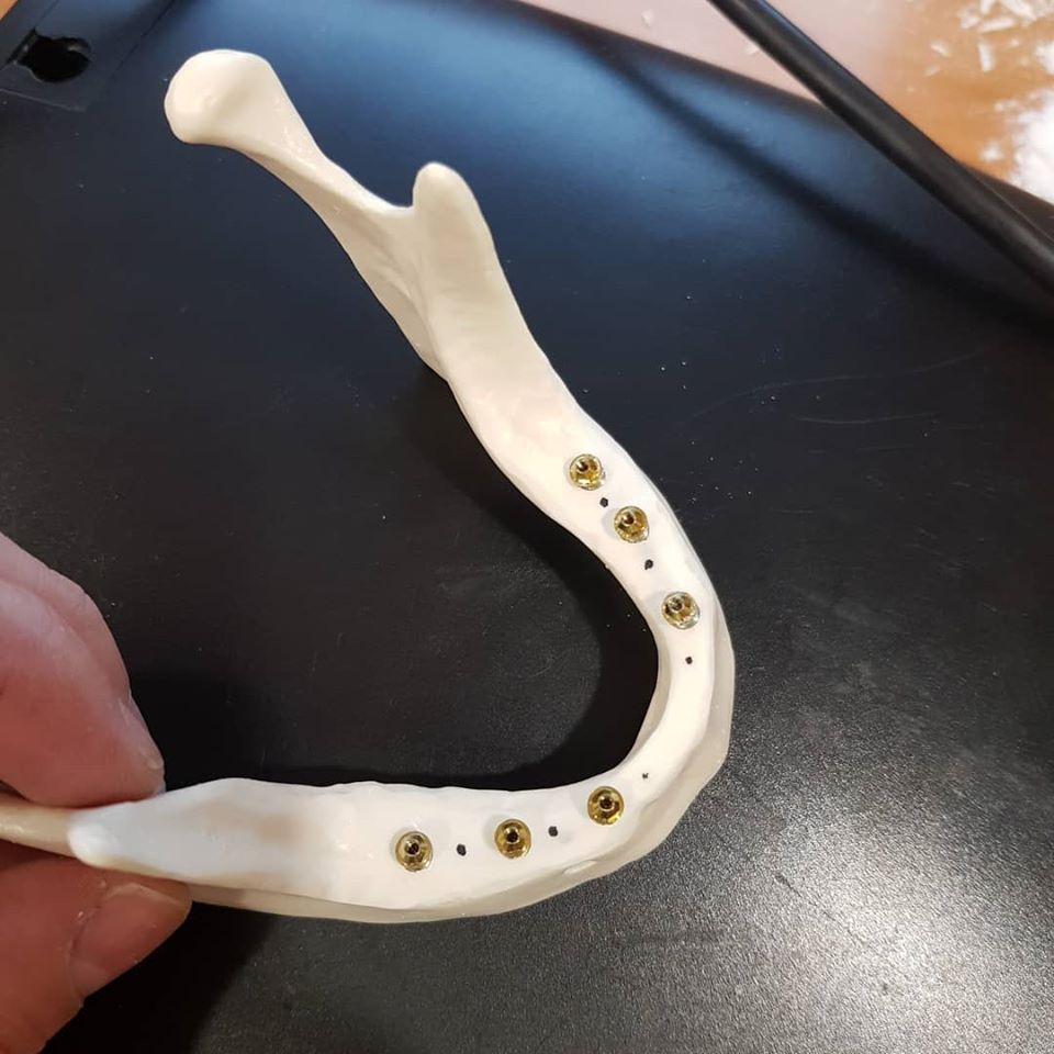 Пермь, 16 ноября: Экспертный курс по тотальной имплантации и протезированию при полном отсутствии зубов. Данилов А.А.