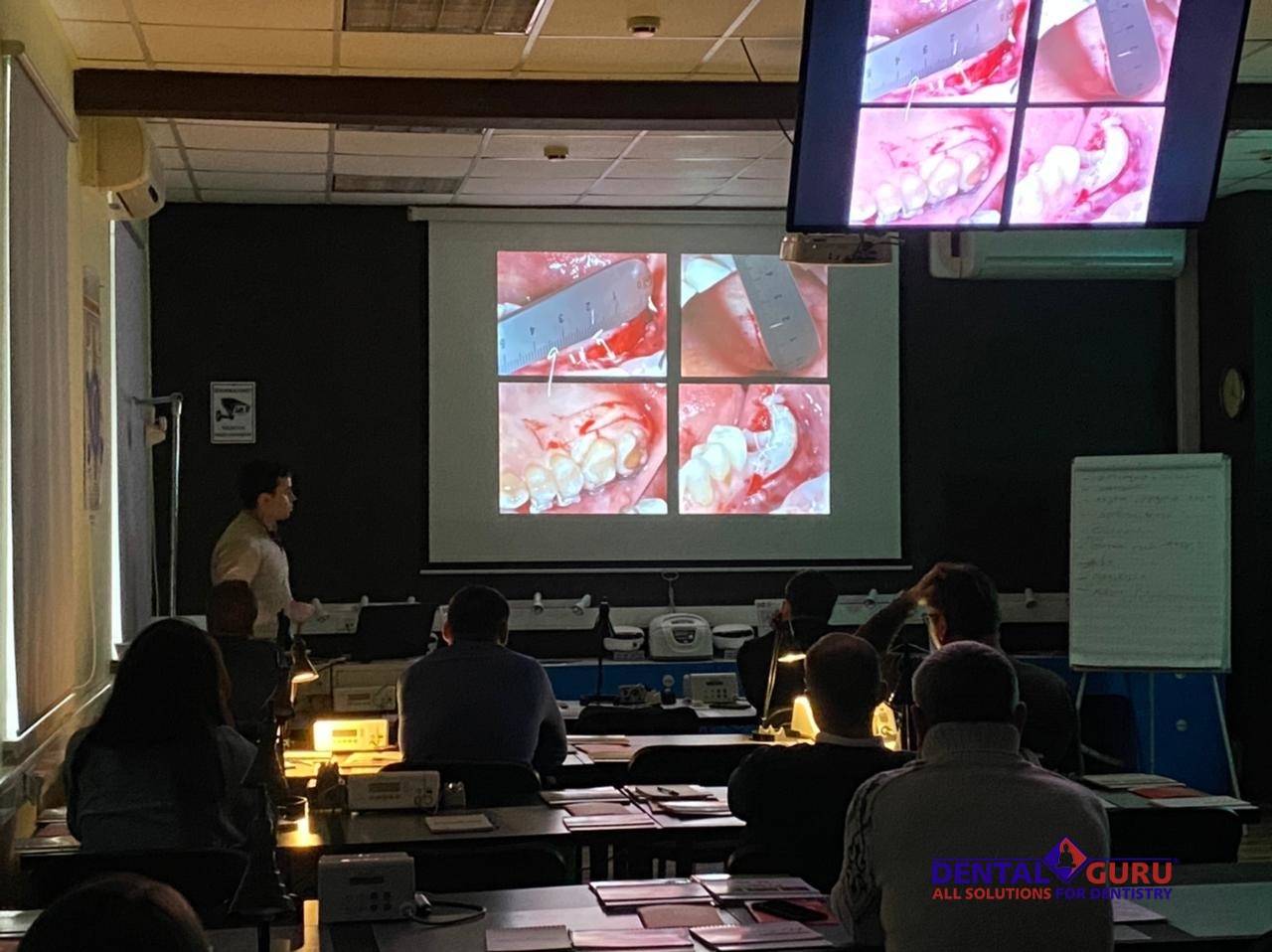 Пластика мягких тканей вокруг имплантатов. Морфологический подход. Пост-релиз 11-12 февраля