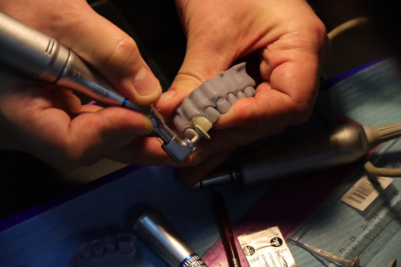 Прямые композитные виниры. Полный алгоритм и немного больше