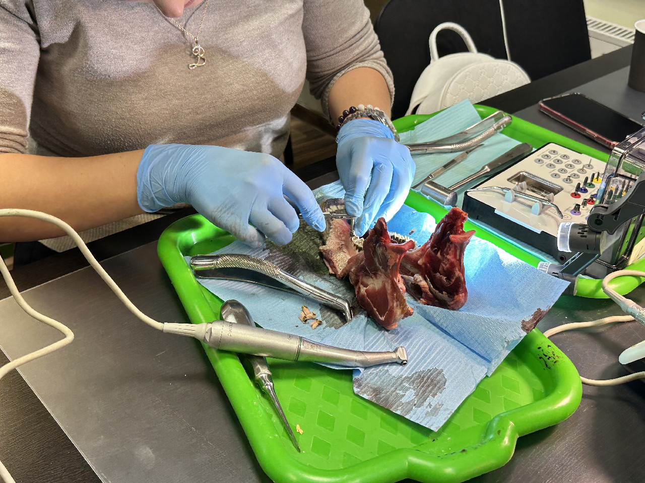 Одномоментная имплантация и немедленная нагрузка